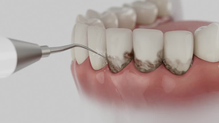 Reliable Dental Implants contractor in Springfield, TN by Smile Center Dentistry